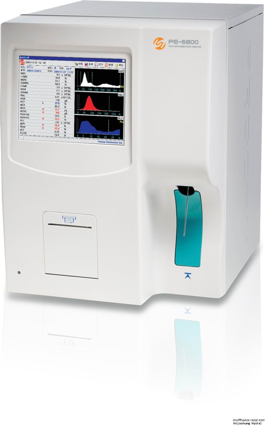 Analyseur de cellules sanguines de L'hopital de néphrologie de Shijiazhuang 