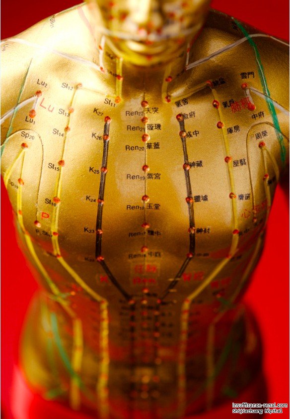 L’acupuncture au medicament traditionnel chinoise