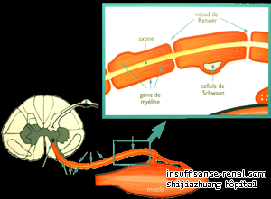 La néphropathie périphérique
