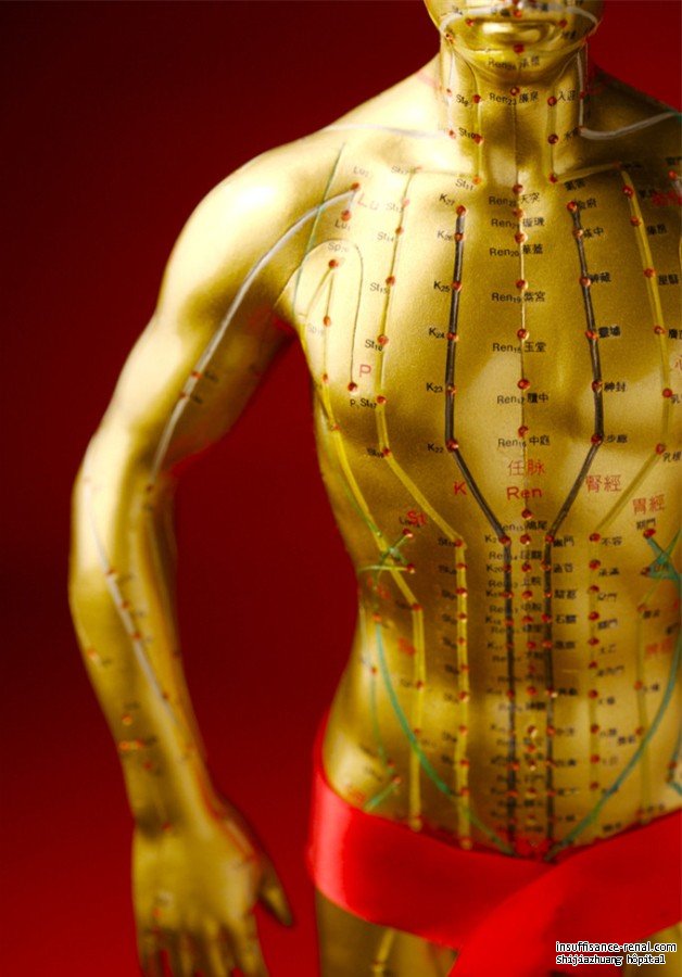 le rôle important de thérapie d’acupuncture au traitement de maladie néphrotique