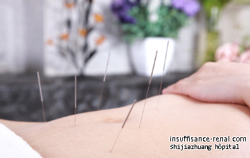  Peut l’acupuncture réparer les reins endommagés