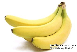 Quelques avantages pour les patients de néphropathie IgA manger la banane 