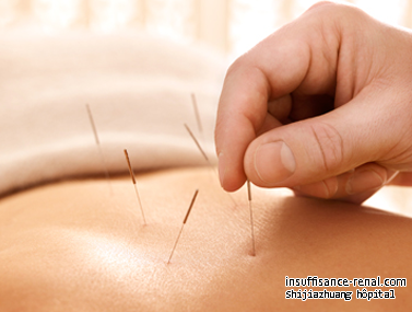 L’ acupuncture peut réduire la créatinine élevée