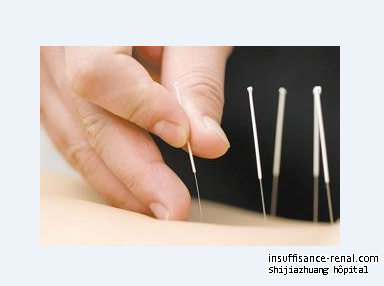 La médecine traditionelle chinoise: Acupuncture pour l’insuffisance rénale chronique