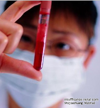 Créatinine 7.6 et uréique sanguin 111: Peut-il être atténué efficacement