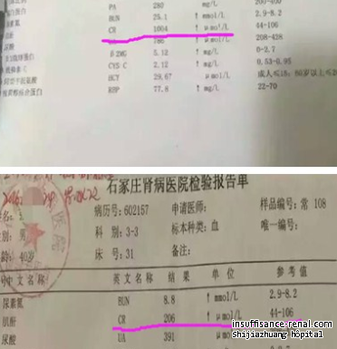 Comment traiter la créatinine élevée dans l’hôpital de Néphropathie de Shijiazhuang