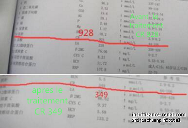 Comment réduire la créatinine élevée pour le patinets atteints de la maladie rénale
