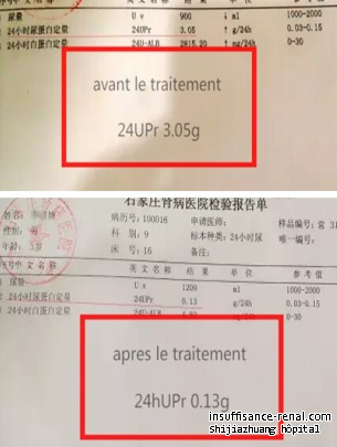 L’insufisance rénale chronique: 24hUPr 6.27g à 1.58g