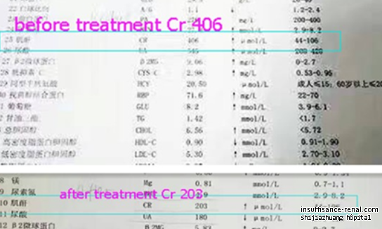 Il est possible d'abaisser la créatinine 406 à 203umol / L Sans dialyse