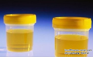 Pourquoi Urine Sortie Diminutions apres la dialyse