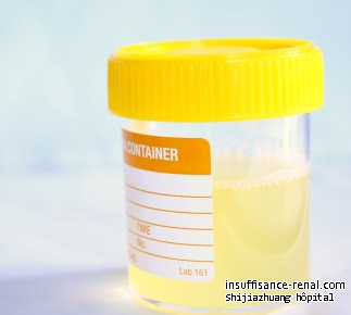 Pourquoi Urine Sortie Diminutions post dialyse