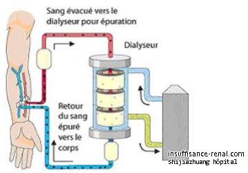 Les effets secondaires après la dialyse