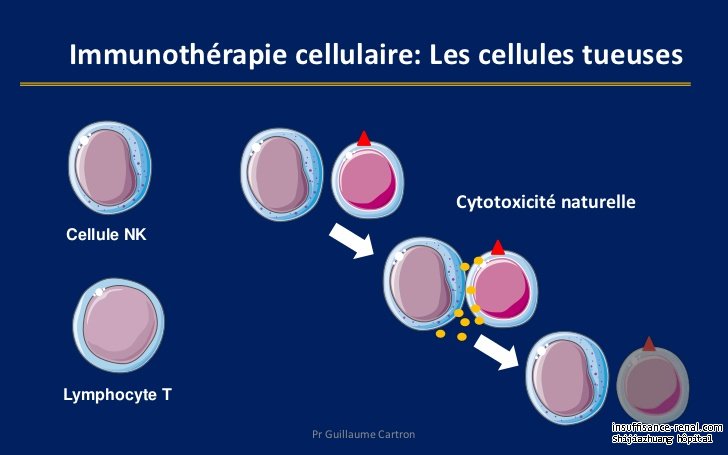 Comment réduire la créatinine élevée avec le naturel traitement