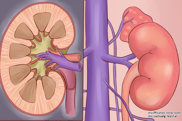 Insuffisance rénale : Augmenter la fonction rénale permet d’éviter la dialyse