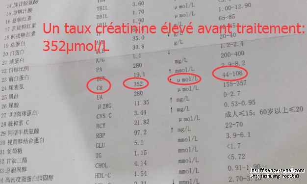 Comment débarrasser de dialyse avec la micro médecine chinoise osmothérapie ?