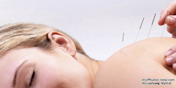 Comment l’acupuncture réduit la créatinine?