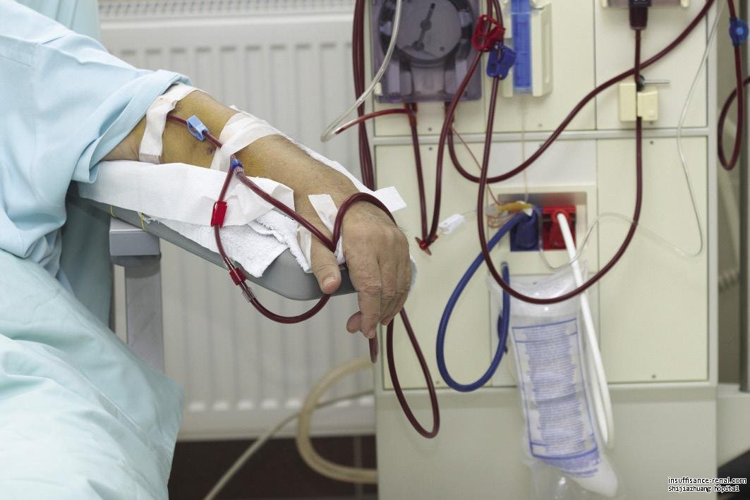 Est la dialyse la meilleure méthode sur les patients souffrant de la maladie rénale ? 