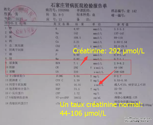 Hyalinose segmentaire et focale – traitement